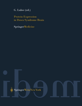 Immagine di copertina: Protein Expression in Down Syndrome Brain 1st edition 9783211837320