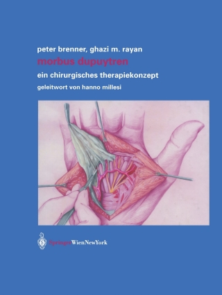 Cover image: Morbus Dupuytren 9783709173923