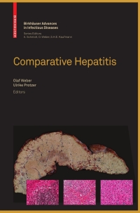 Cover image: Comparative Hepatitis 1st edition 9783764385576