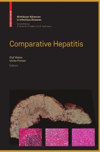 صورة الغلاف: Comparative Hepatitis 1st edition 9783764385576