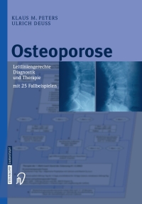 表紙画像: Osteoporose 9783798514652