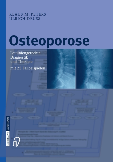 Osteoporose: Leitliniengerechte Diagnostik und Therapie mit 25 Fallbeispielen - FULL INSTANT DOWNLOAD | PDF DOCX EPUB