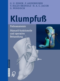 Cover image: Klumpfuß 9783798514850