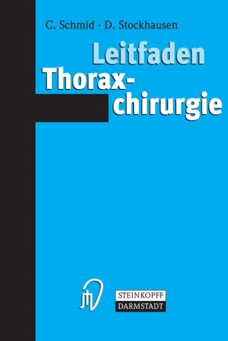 Cover image: Leitfaden Thoraxchirurgie 9783798515109