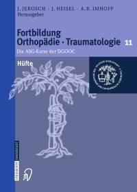 Cover image: Hüfte 1st edition 9783798515543