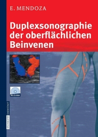 Immagine di copertina: Duplexsonographie der oberflächlichen Beinvenen 9783798515772