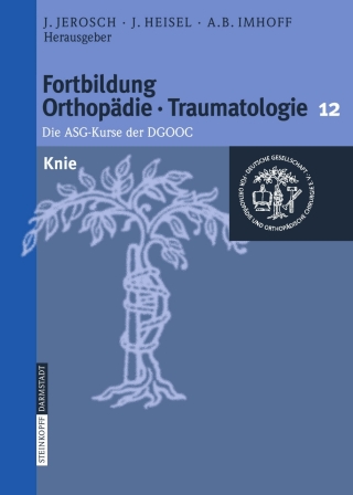 Imagen de portada: Knie 1st edition 9783798515871