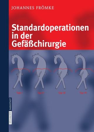 Cover image: Standardoperationen in der Gefäßchirurgie 9783798514607