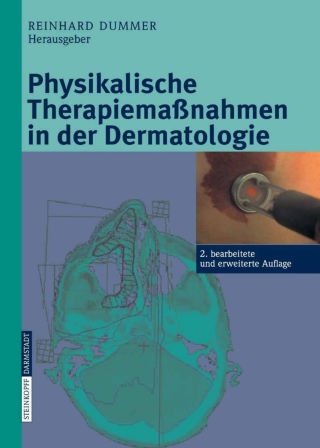Cover image: Physikalische Therapiemaßnahmen in der Dermatologie 2nd edition 9783798516250
