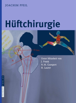 Cover image: Hüftchirurgie 9783798516274