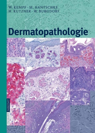 Cover image: Dermatopathologie 9783798516472