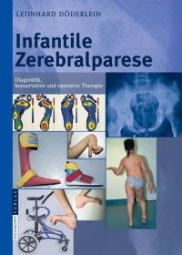 Cover image: Infantile Zerebralparese 9783798517004