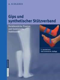 Cover image: Gips und synthetischer Stützverband 2nd edition 9783798514843