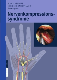 Cover image: Nervenkompressionssyndrome 9783798518186
