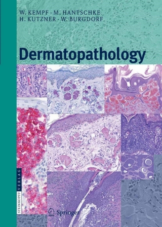 Imagen de portada: Dermatopathology 9783798518391