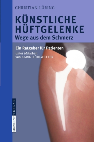 Cover image: Künstliche Hüftgelenke 9783798518919
