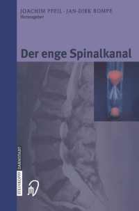 Cover image: Der enge Spinalkanal 1st edition 9783798514645