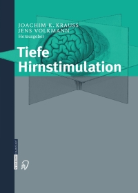 Cover image: Tiefe Hirnstimulation 1st edition 9783798514126