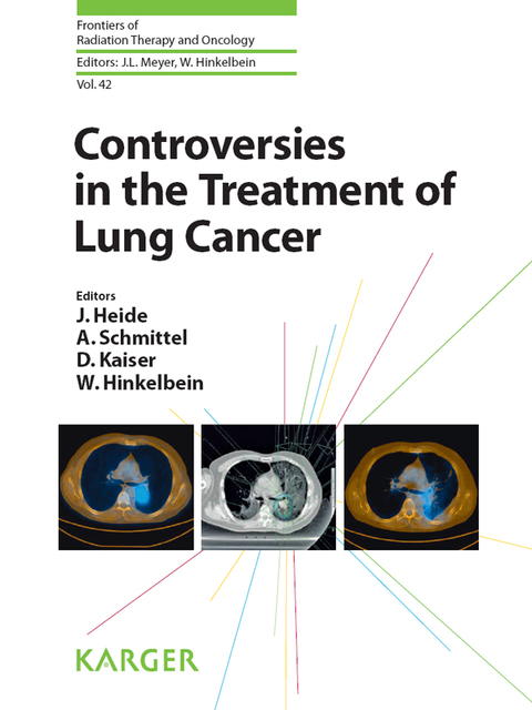 Controversies in the Treatment of Lung Cancer: 12th International Symposium on Special Aspects of Radiotherapy, Berlin, October 2008, 1st Edition - FULL INSTANT DOWNLOAD | PDF DOCX EPUB