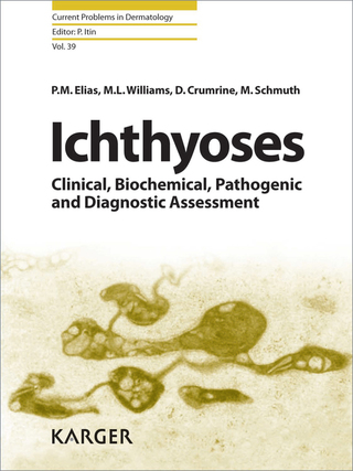Cover image: Ichthyoses 1st edition 9783805593946