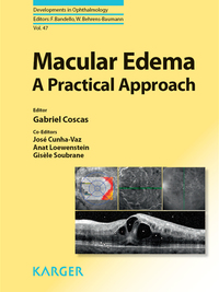 Cover image: Macular Edema 9783805594349