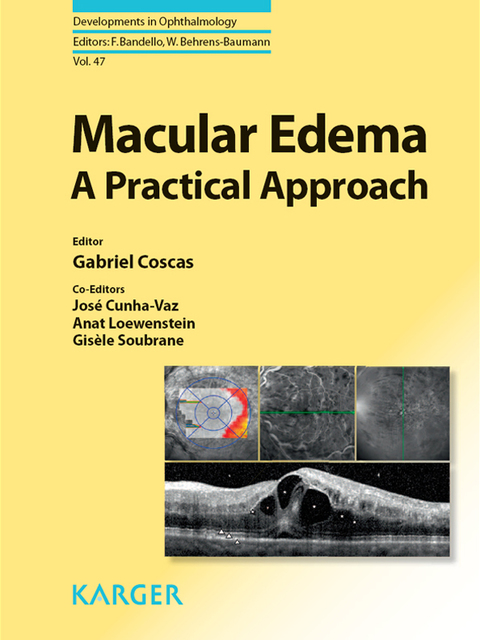 Macular Edema: A Practical Approach, 1st Edition - FULL INSTANT DOWNLOAD | PDF DOCX EPUB