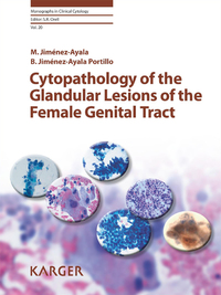 Omslagafbeelding: Cytopathology of the Glandular Lesions of the Female Genital Tract 9783805594646