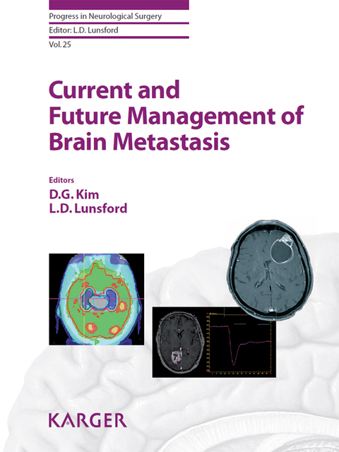 Current and Future Management of Brain Metastasis - FULL INSTANT DOWNLOAD | PDF DOCX EPUB