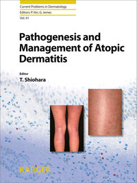 Imagen de portada: Pathogenesis and Management of Atopic Dermatitis 9783805596862