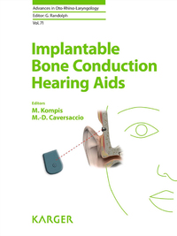 صورة الغلاف: Implantable Bone Conduction Hearing Aids 9783805596992