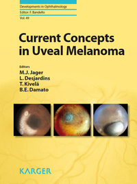 Titelbild: Current Concepts in Uveal Melanoma 9783805597906