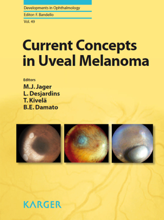 表紙画像: Current Concepts in Uveal Melanoma 1st edition 9783805597906