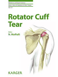 Cover image: Rotator Cuff Tear 9783805598149