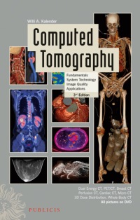 Cover image: Computed Tomography: Fundamentals, System Technology, Image Quality, Applications 3rd edition 9783895783173