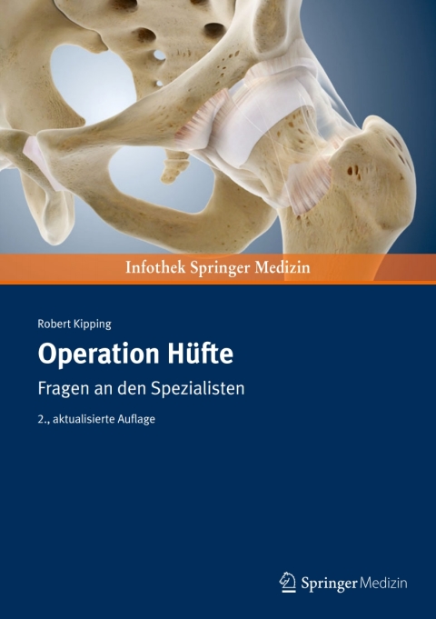 Operation Hüfte: Fragen an den Spezialisten, 2nd Edition - FULL INSTANT DOWNLOAD | PDF DOCX EPUB