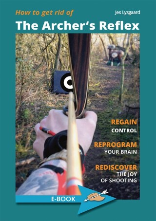 Cover image: How to get rid of the Archer's Reflex 1st edition 9783938921852