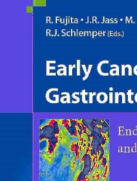 Cover image: Early Cancer of the Gastrointestinal Tract 1st edition 9784431228721