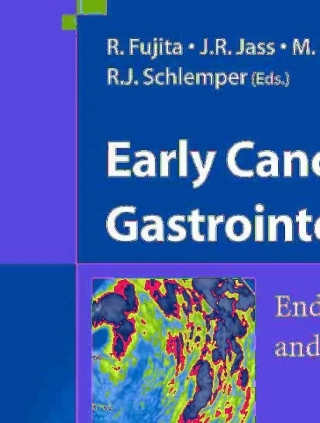 Immagine di copertina: Early Cancer of the Gastrointestinal Tract 1st edition 9784431228721