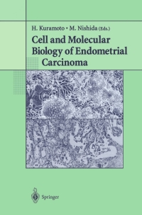 Cover image: Cell and Molecular Biology of Endometrial Carcinoma 1st edition 9784431006138