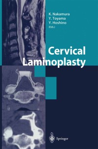 Cover image: Cervical Laminoplasty 1st edition 9784431703044