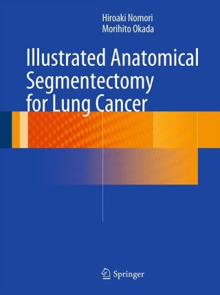 Cover image: Illustrated Anatomical Segmentectomy for Lung Cancer 9784431541431