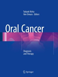 Cover image: Oral Cancer 9784431549376