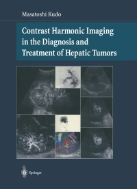 Imagen de portada: Contrast Harmonic Imaging in the Diagnosis and Treatment of Hepatic Tumors 9784431659068