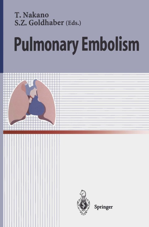 Pulmonary Embolism, 1st Edition - FULL INSTANT DOWNLOAD | PDF DOCX EPUB