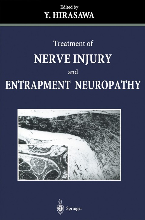 Treatment of Nerve Injury and Entrapment Neuropathy, 1st Edition - FULL INSTANT DOWNLOAD | PDF DOCX EPUB