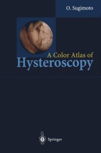 صورة الغلاف: A Color Atlas of Hysteroscopy 9784431702443