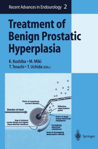 Cover image: Treatment of Benign Prostatic Hyperplasia 1st edition 9784431702849