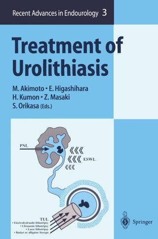 Cover image: Treatment of Urolithiasis 1st edition 9784431703129