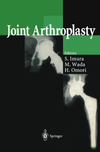 Cover image: Joint Arthroplasty 1st edition 9784431702412