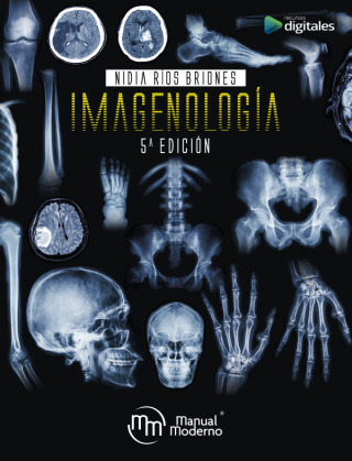 Cover image: Imagenología 5th edition 9786074489392